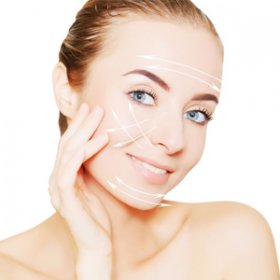 Tca peeling Amersfoort