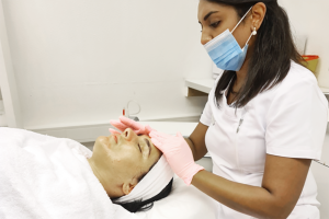 Alless Over Chemisch Peeling